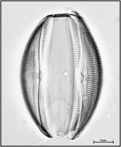 Amphora ovalis (Kützing) Kützing, 1844