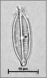 Craticula accomoda (Hustedt) Mann in Round, Crawforf & Mann, 1990
