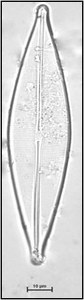Craticula cuspidata (Kützing) DG Mann ex Rotonda et al. (1990)