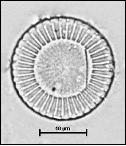 Cyclotella meneghiniana Kutzing, 1844