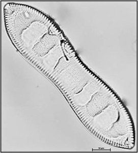 Cymatopleura solea (Brebisson) Smith , 1851