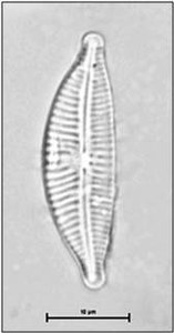 Cymbella affinis Kützing, 1844