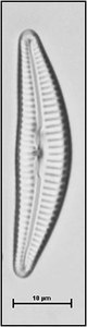 Cymbella cymbiformis Agardh, 1830