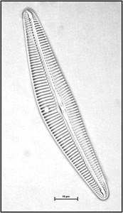 Cymbella helvetica Kützing, 1844