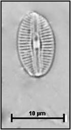 Diploneis oblongella (Nägeli ex Kützing) Cleve-Euler in Cleve-Euler & Osvald, 1922