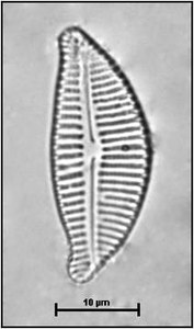 Encyonema caespitosum var. caespitosum Kützing, 1849