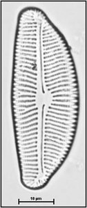 Encyonema prostratum Berkeley, 1844