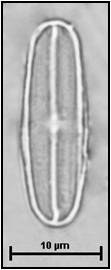 Fallacia subhamulata (Grunow) Mann in Round, Crawford & Mann 1990
