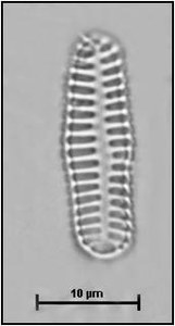Fragilaria pinnata  var. intercedens (Grunow) Hamilton in Hamilton et al. 1994