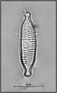 Fragilaria recapitellata Lange-Bertalot & Metzeltin, 2009